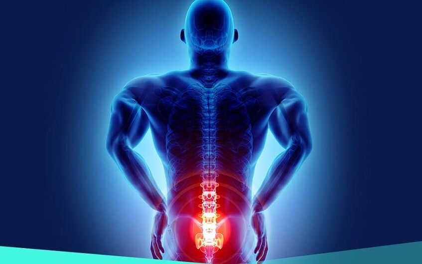 pain in osteoarthritis of the hip