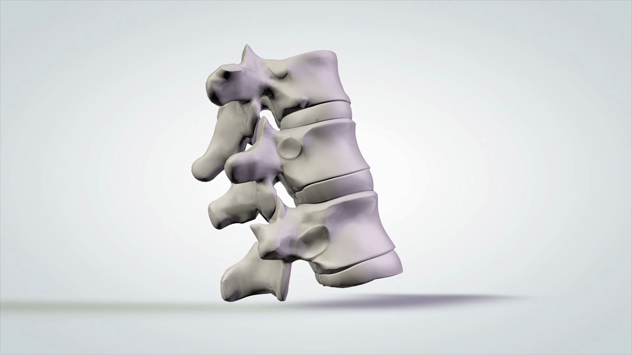 spine injury in cervical osteochondrosis